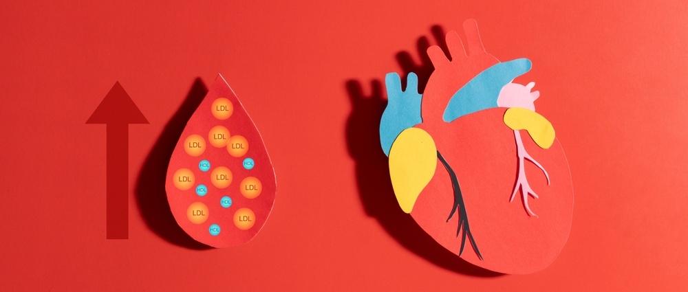 Understanding your cholesterol levels