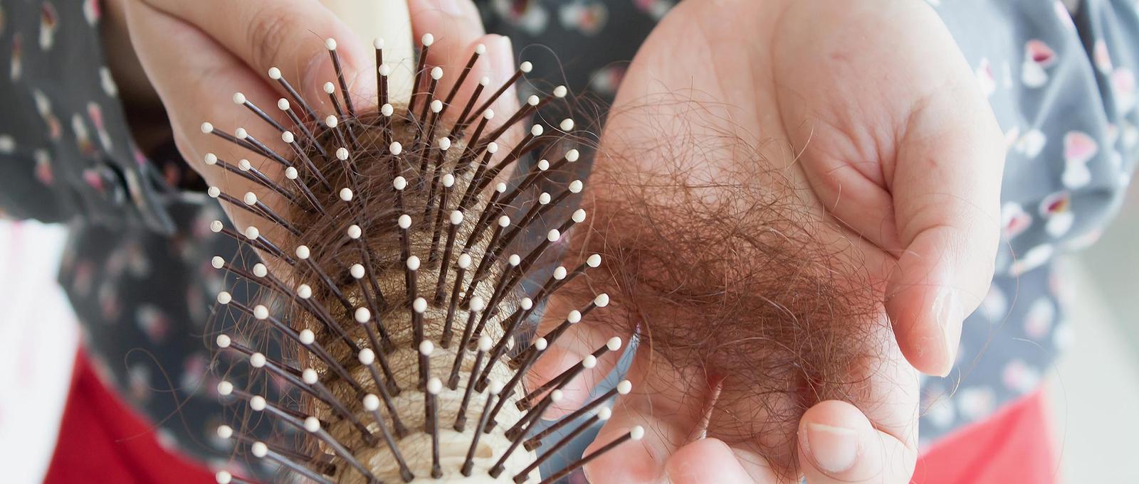 Understanding female hair loss