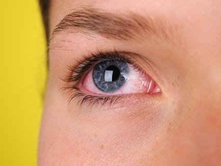 eye problems