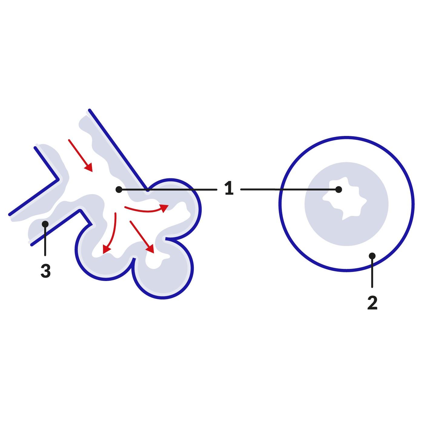 Cross-section of airway during asthma attack