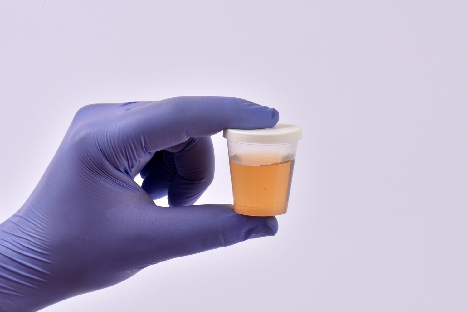 Lower urinary tract symptoms in men