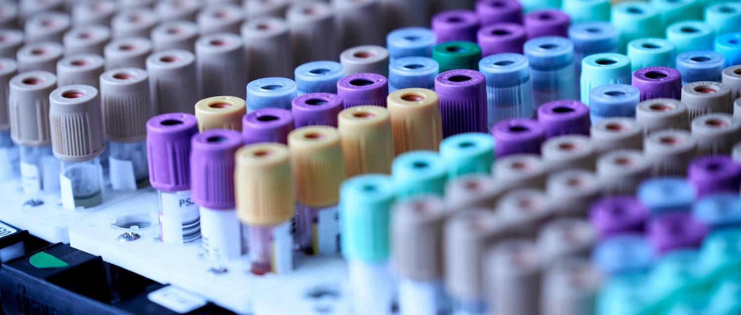 COVID-19 swab antibody