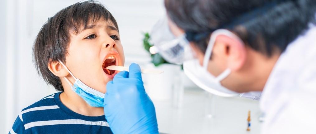 10 common questions about tonsil stones